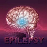 Diagnosis Epilepsi