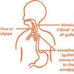 Atresia esofagus adalah