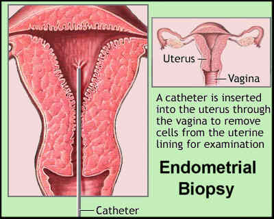 Endometrium merupakan lapisan terluar dari rahim