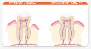 Tips Untuk gigi Sensitif