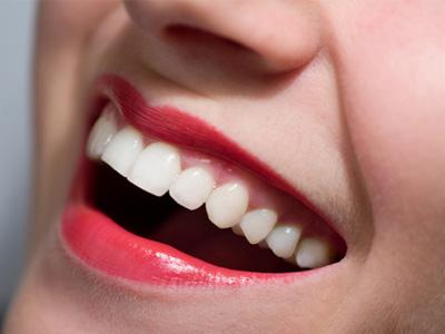 Cara Mudah Menjaga Gigi Tetap Putih
